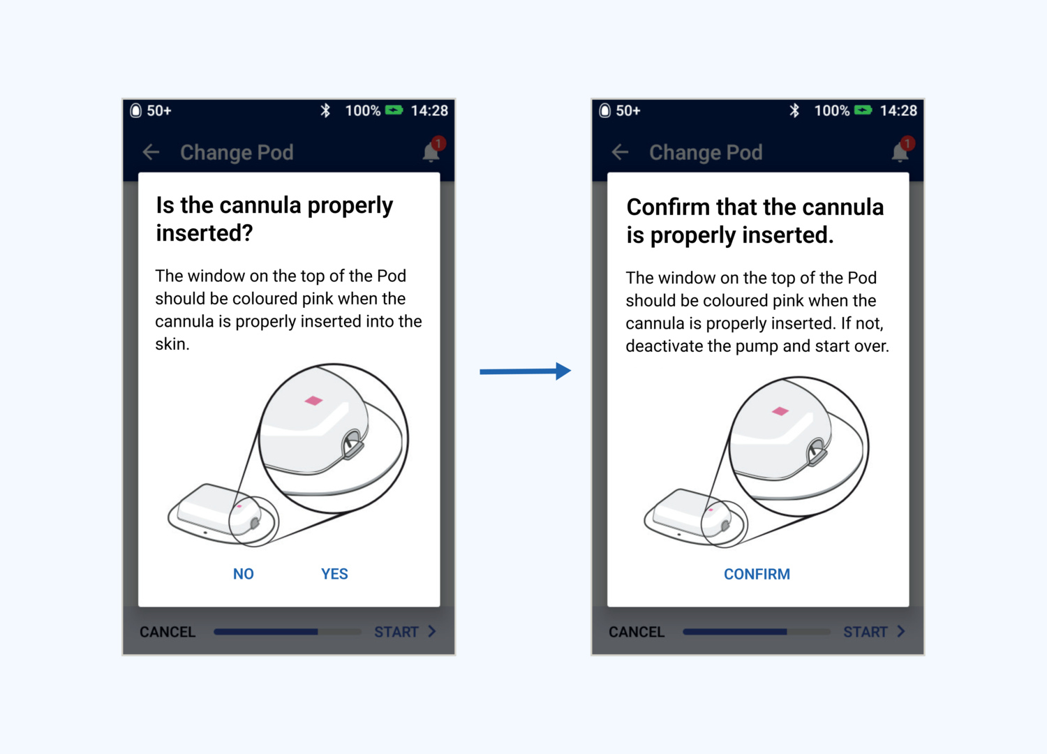 UX during pod change