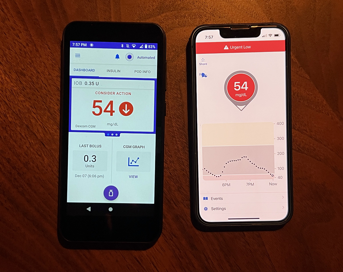 A photo of the Omnipod 5 PDM and an iPhone running the Dexcom app.